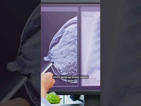 Q&A: Lumps vs. Mammograms