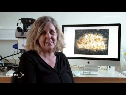 Doku planet e    HD   Der Plastik Fluch   Wie wir unseren Planeten vermuellen