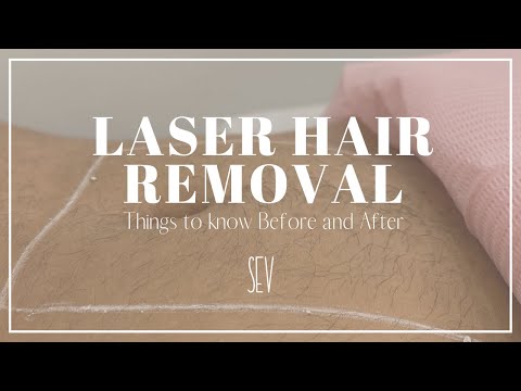 Laser Hair Removal: Things To Know Before & After