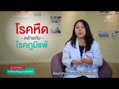 กลากเหรียญในเด็ก ความสงสัยของโรคสะเก็ดเงินบนหัว