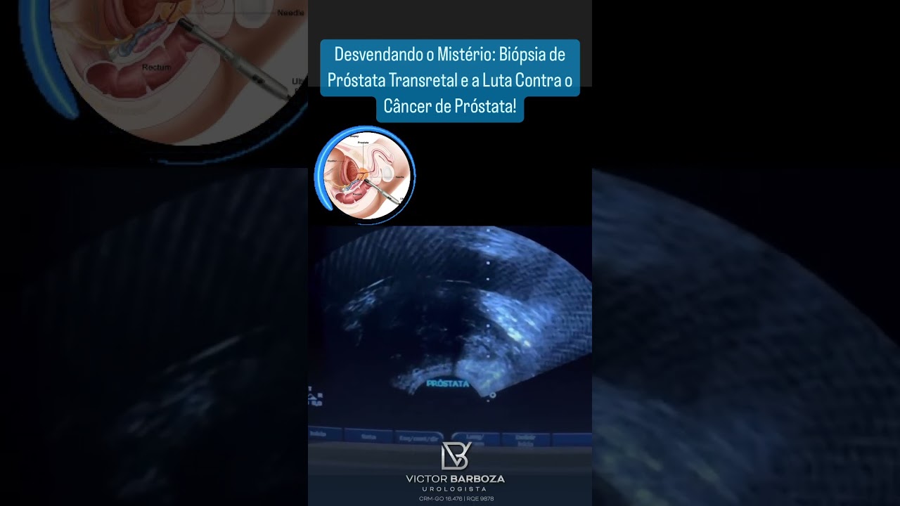 Victor Gomes Barboza-26