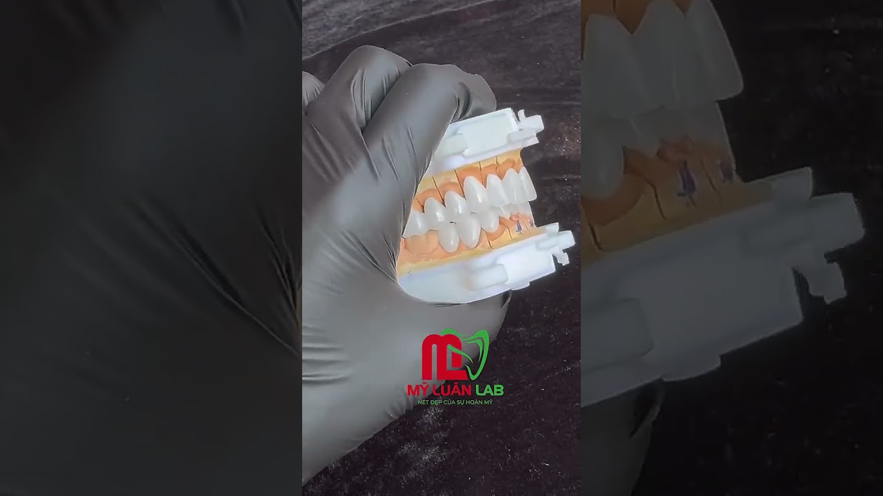 Lời cảm ơn từ Mỹ Luân Dental Lab