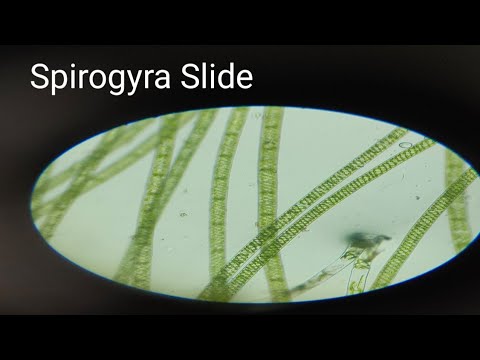 preprations of  Spirogyra Slide  alge slide Fresh water alge