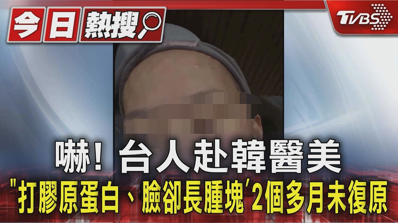 獨/嚇!台人赴韓醫美「打膠原蛋白、臉卻長腫塊」