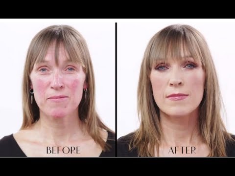 download lagu mp3 mp4 Charlotte Tilbury Rosacea, download lagu Charlotte Tilbury Rosacea gratis, unduh video klip Charlotte Tilbury Rosacea