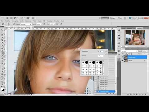 Macchie scure a pelle del membro Eliminare posti di pigmentary su una faccia