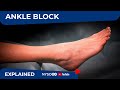 Regional Anesthesia Ultrasound-Guided Ankle Block