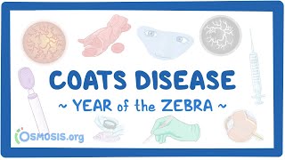 Coats disease (Year of the Zebra 2024)
