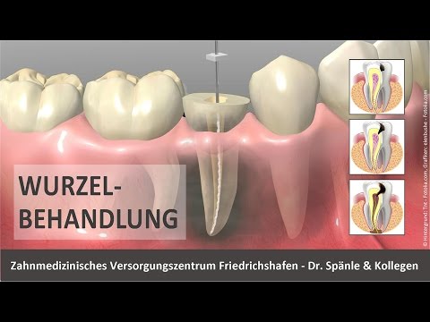 Prostata Schmerzen bei der Erektion Positive Biopsie der Prostata-Adenom