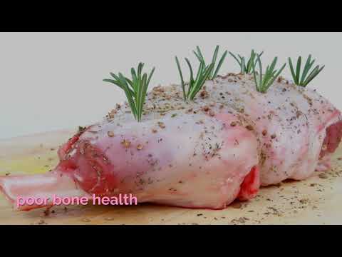 Hypercalcemia Symptoms, causes, diagnosis, and treatment