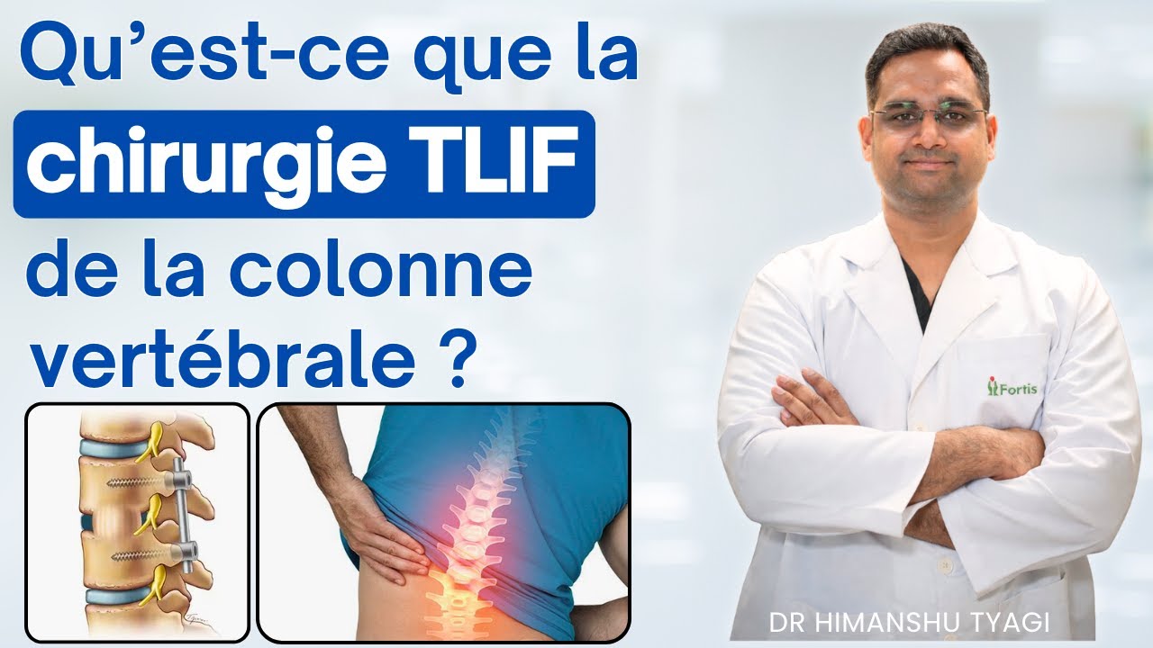 What is TLIF surgery of the spine? | What is TLIF surgery in the spine? (in French)