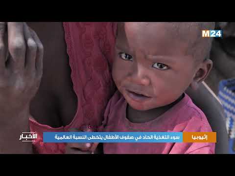 الأمم المتحدة: سوء التغذية الحاد في صفوف الأطفال بإثيوبيا يتخطى النسبة العالمية