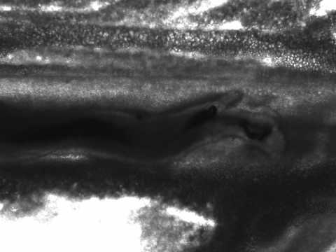 Quale analisi su un lyambliya è più efficace Helminths in pollo