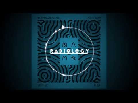 Matoma & Becky Hill - False Alarm (Radiology Remix)