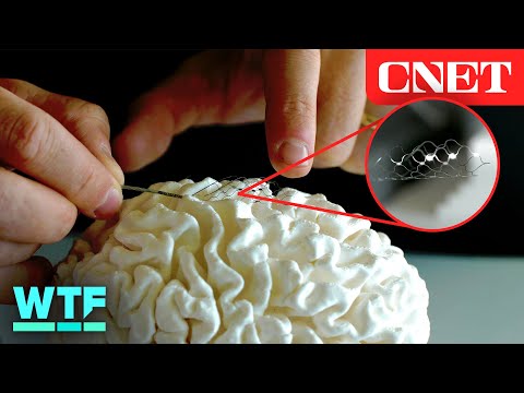 Brain-Computer Interface: No Open Brain Surgery Required 🧠