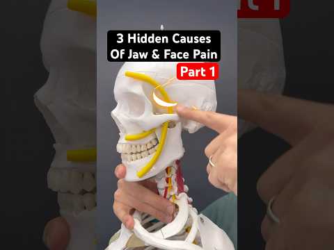 Part 1 of 2 - Is trigeminal neuralgia the cause of your pain? #trigeminalneuralgia #tmj #tmd