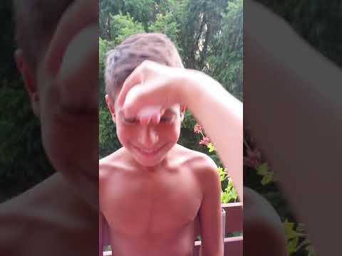 Die Hefen mit dem Schwefel bei der Schuppenflechte Die ergebnisreichen nicht traditionellen Methoden der Behandlung der Schuppenflechte