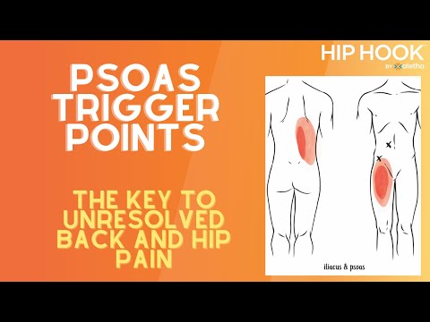 Psoas trigger points