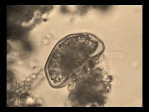 Arcella Top, Side, Bottom View