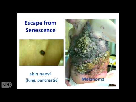 Epigenetic Regulation of Senescence and Aging