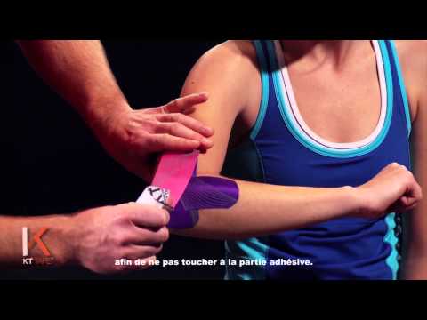 comment soigner tennis elbow