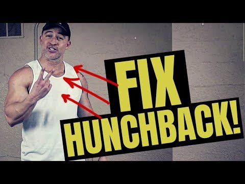 BEST Exercises To Get Rid Of Hunchback Fast (try these!)