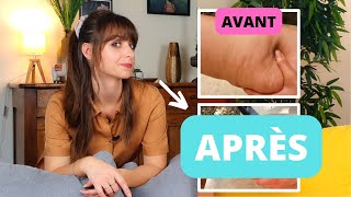 J'ai ENFIN trouvé LE sport ANTICELLULITE!! (et mes résultats le prouvent)