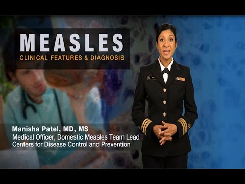 Measles Clinical Features and Diagnosis