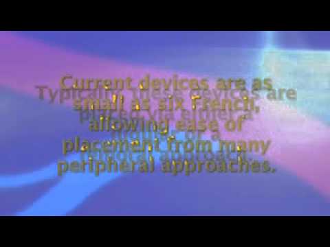 Inferior Vena Cava Filters