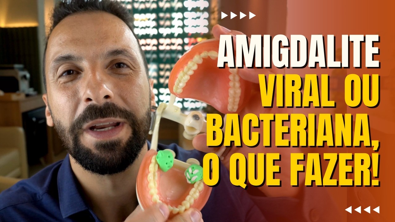 Diferença entre Amigdalite Viral e Bacteriana, como tratar