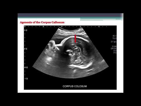 The 18 - 20 Week Anatomy Scan | Kelly Raffin | Advanced Fetal Imaging Conference