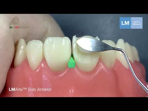 LM-Arte™ Solo instruments for your daily restorative cases