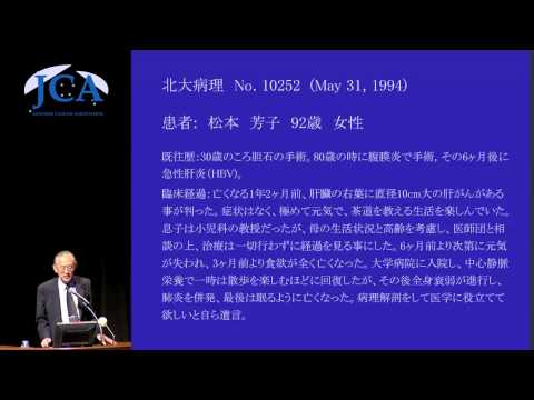 栄養学科 講演5「天寿がん思想とその進展」 北川　知行（公益財団法人　がん研究会がん研究所　名誉所長）