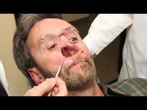 The Man With A Hole In His Face: Body Bizarre Episode 3