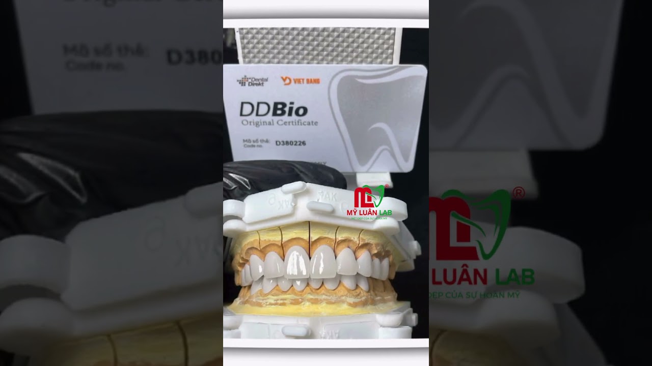 Một mẫu răng sứ đẹp được tạo nên từ sự chỉn chu trong từng chi tiết!