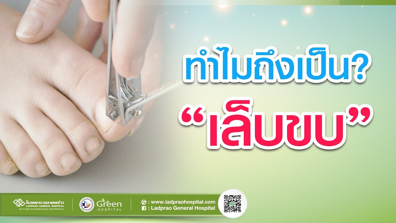 เล็บขบ เกิดจากอะไร