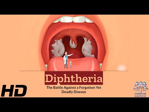 Effects of Cannabis on your body