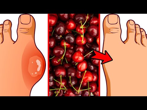 4 Gründe, warum du Kirschen in deine tägliche Ernährung integrieren solltest!