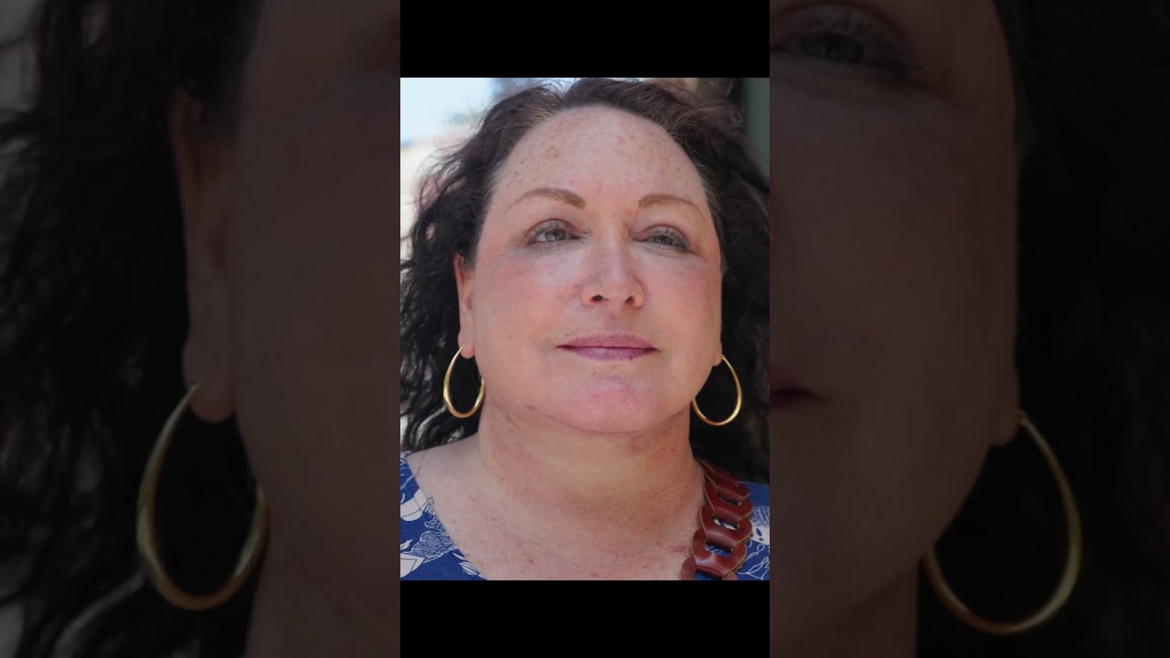 PATIENT HAS 8 SURGERIES TO LOOK & FEEL BETTER #plasticsurgery