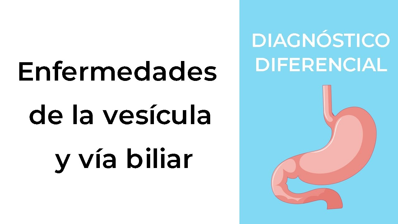 Diagnóstico Diferencial. Enfermedades de la vesícula y vía biliar