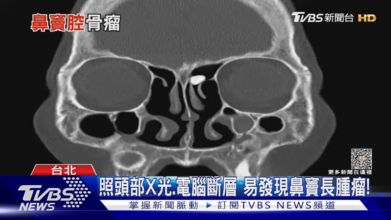 出現「這幾種」常見症狀勿輕忽！　醫師：腫瘤恐「長在這」若延誤治療危及生命！