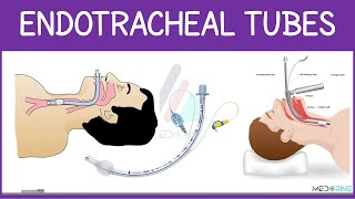 Endotracheal Tubes Explained | Intubation Techniques, Parts of ETT, Tube Care, and Extubation