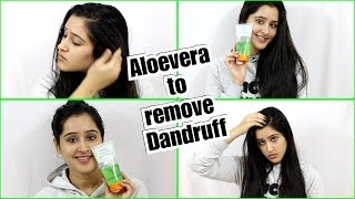 Remove DANDRUFF Using ALOEVERA GEL - 2 Step process to remove dandruff