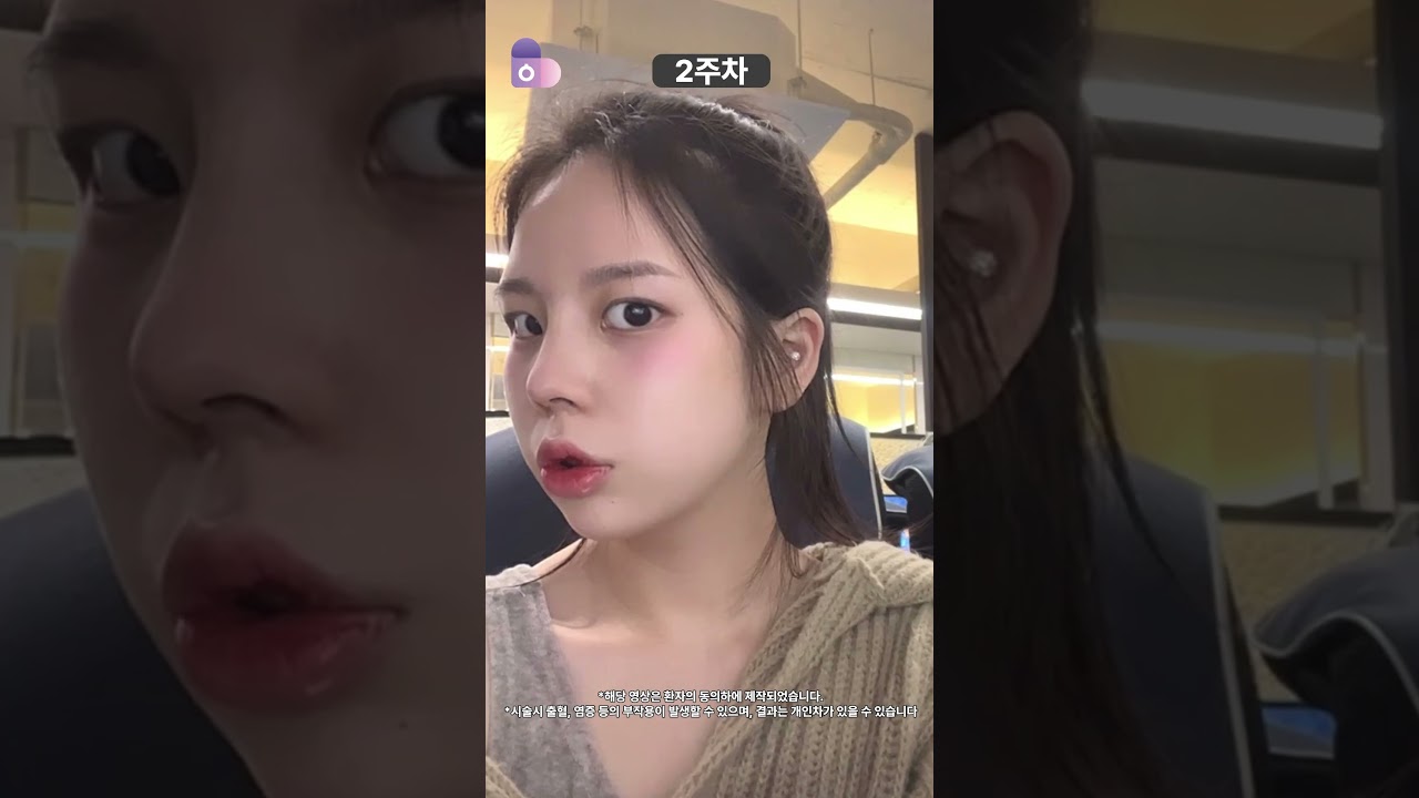 코' 하나로 완성된 분위기