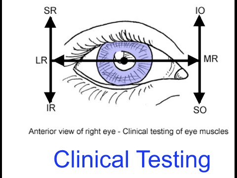 ca test ocular pentru interes