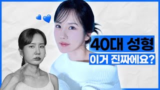 40대성형 이거 진짜에요..? ㅣ성형비포에프터 ㅣ 뷰티라인성형외과