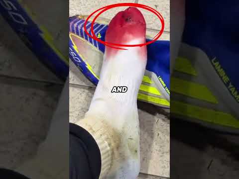 Why Does Yamal Wear 2 Sizes Smaller Boots ? #football