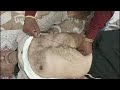 नाभी कौडी नले आतो की सूजन होगी ठीक Navel Nabhi