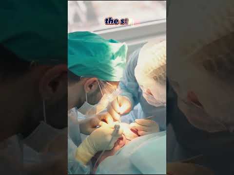 FUT vs FUE Hair Transplant | What Doctors Say?