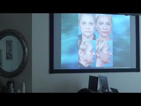 Dr.  J. David Holcomb discusses the pros of the Laser Assisted Facelift at HKPS
